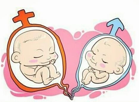 时差培养箱